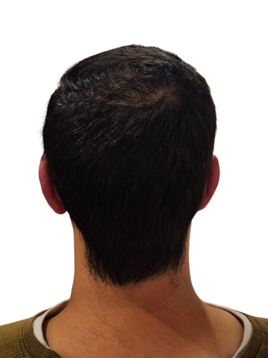 After